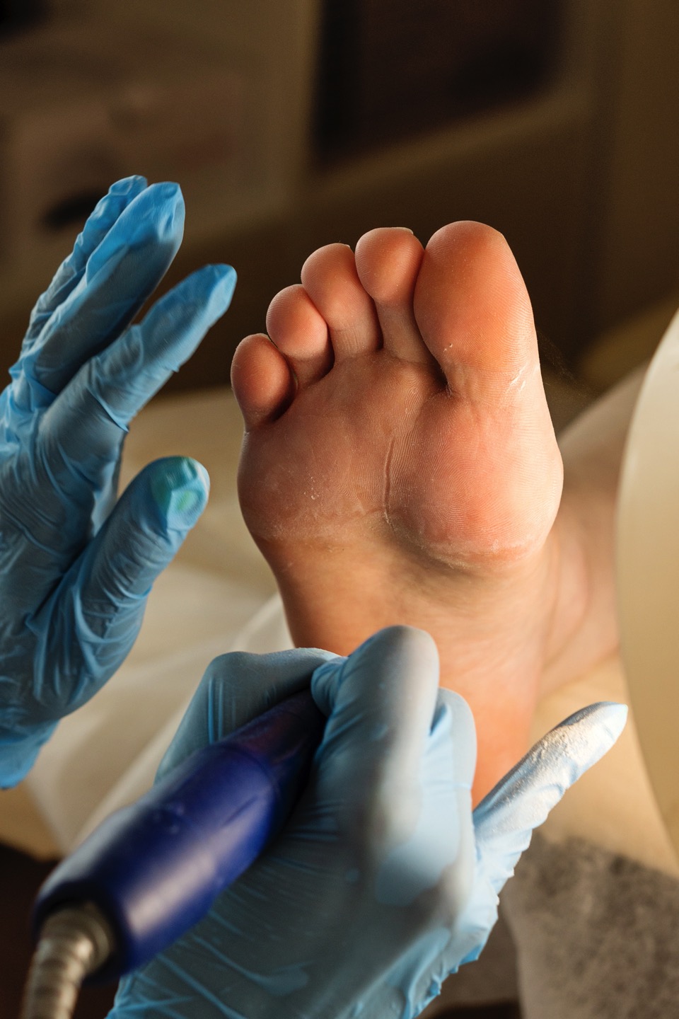 Foot Treatment at Woodley St Podiatry, Reading